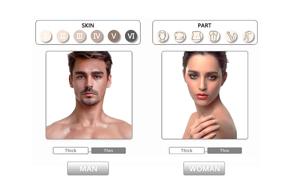 808 nm diodo laser depilazione macchina en103 4