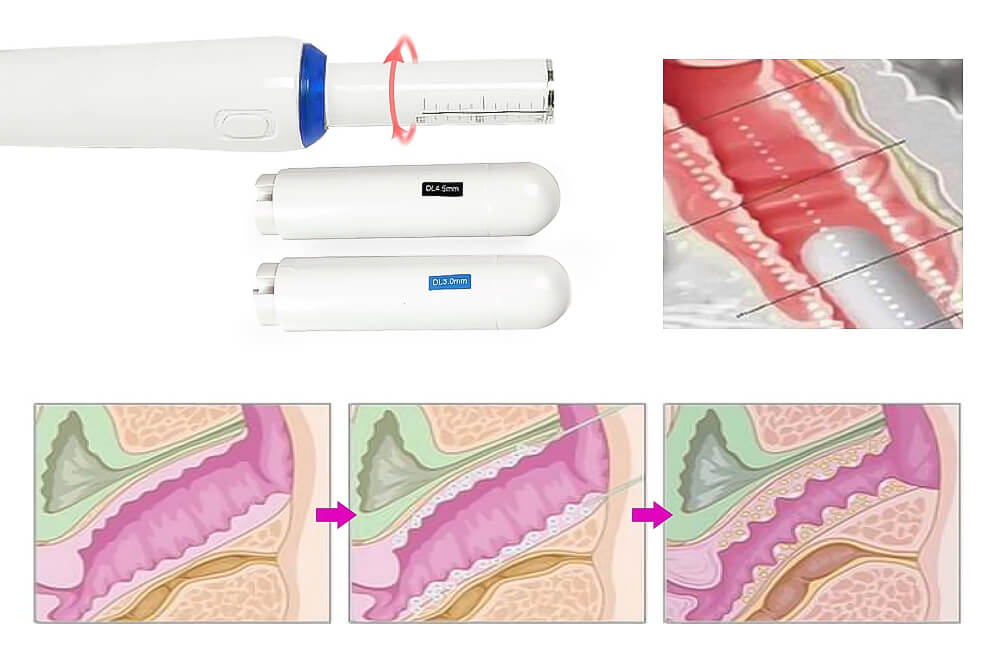 ماكينة هيفو 9D 9D GN072 6
