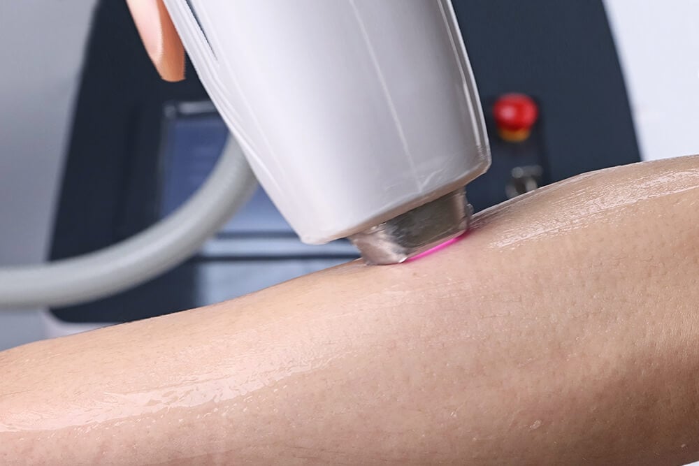 épilateur à diodes en086 7