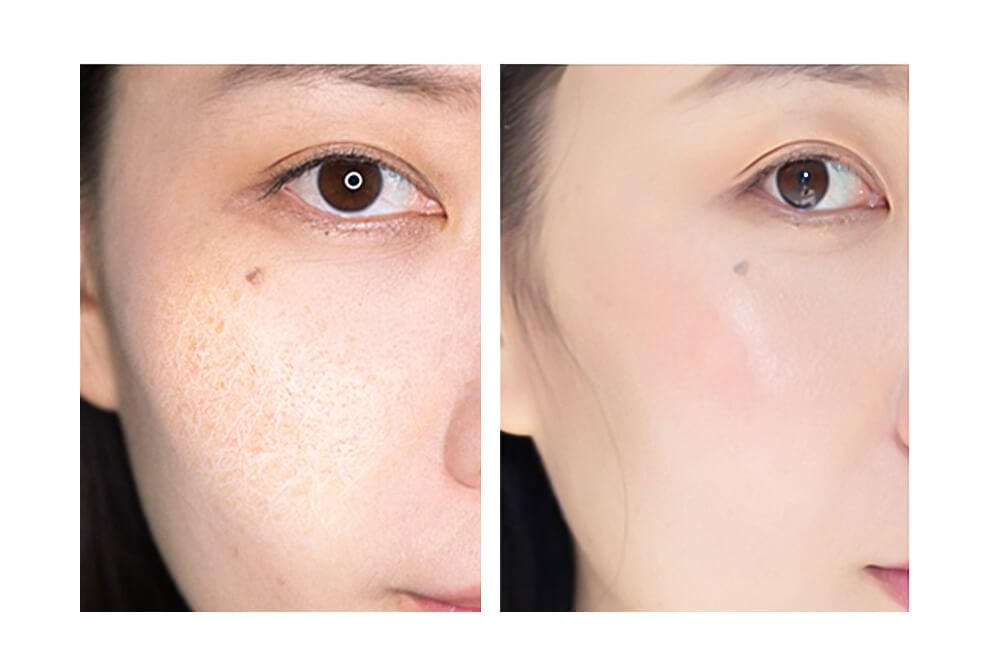 máquina hidrafacial oxigen LB328 1 1