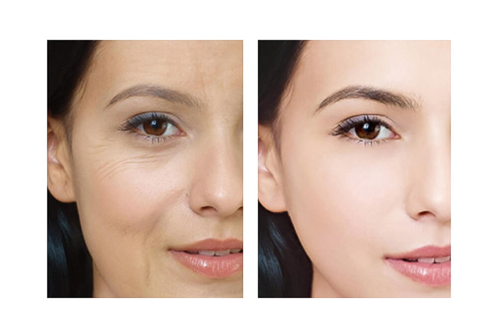 7 цветов LED PDT машина LB357 4