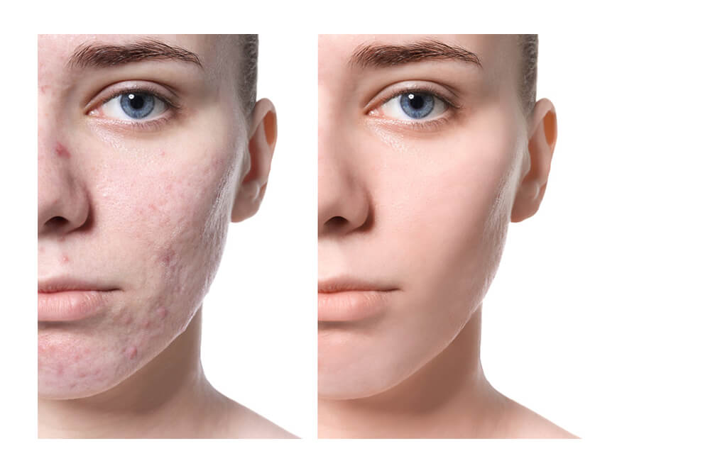 7 цвет LED PDT машина LB357 6