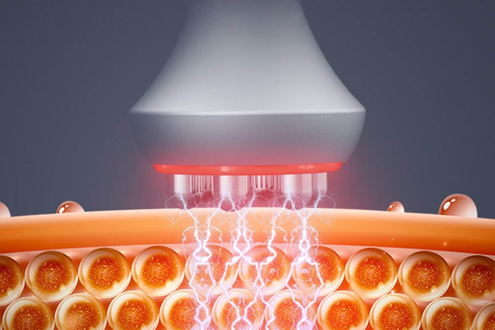 Macchina a cavitazione 80k JF734 1