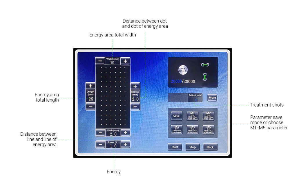 3d hifu Maschine LB270 3