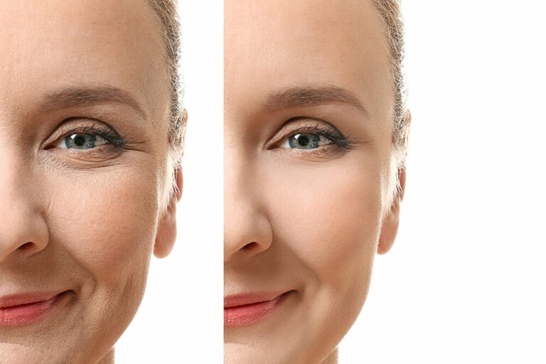 Ultrasonic Cavitation Before and After - konmison
