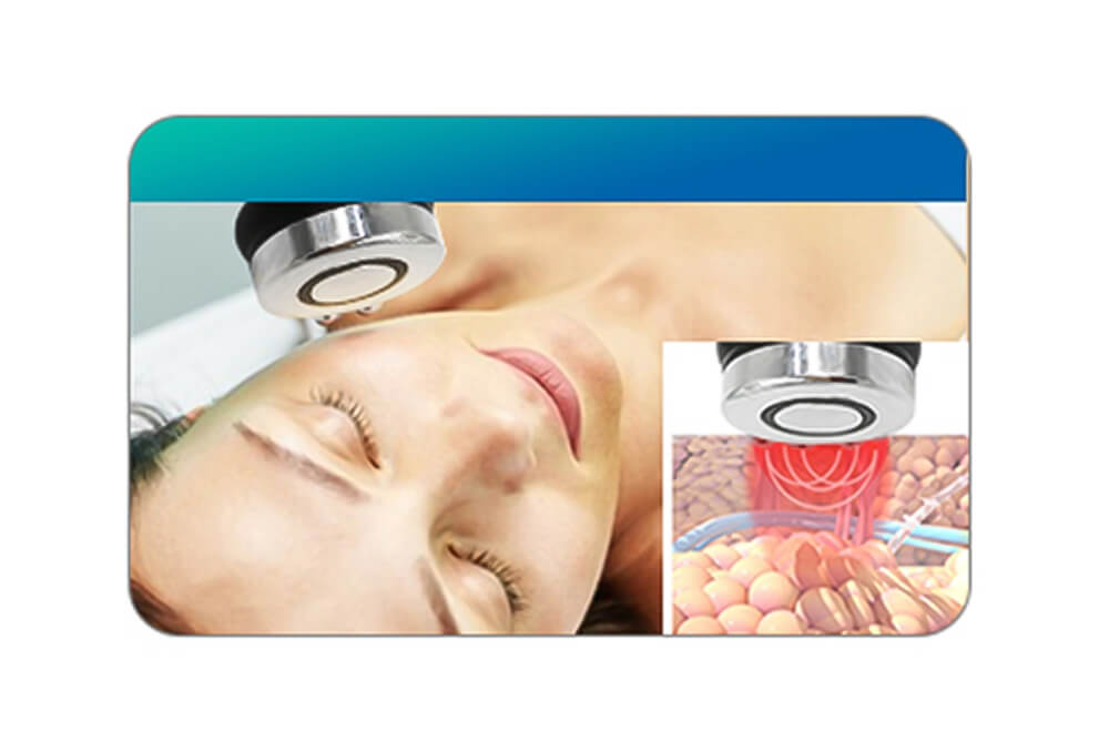 지방 동결 슬리밍 기계 JF671 10