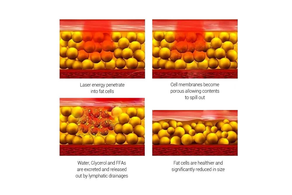6d липо лазерная машина для похудения 6