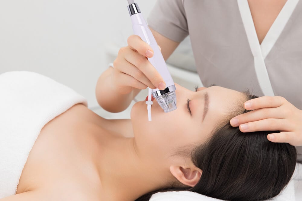 dispositifs de microneedling par radiofréquence 7