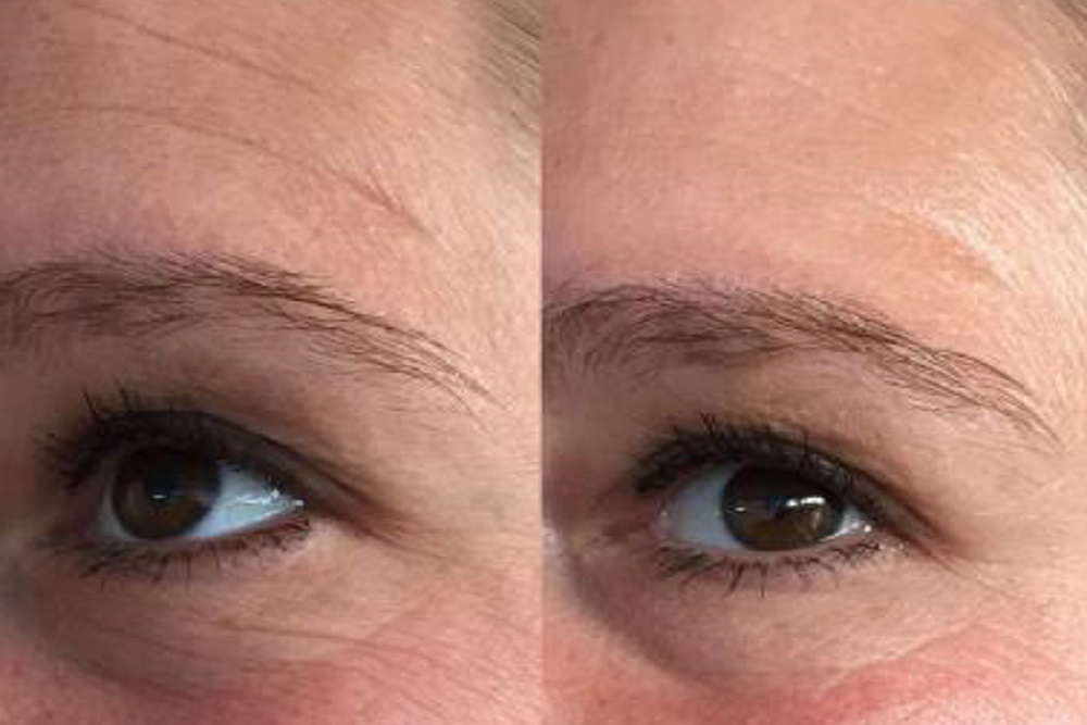 SC256G Máscara LED3 2