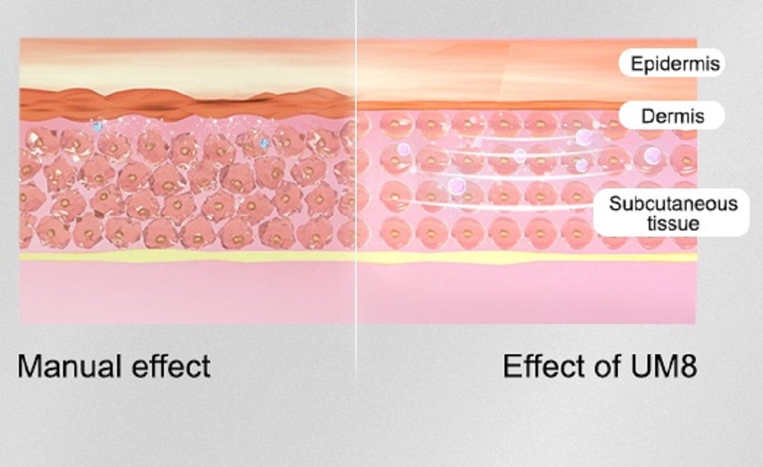 SC1120 UM8 microaguja14