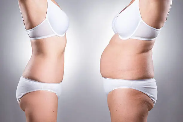 ultrasone cavitatie voor en na 2