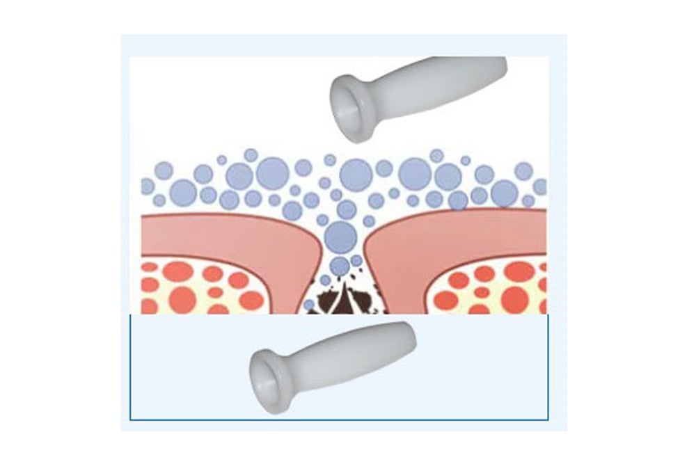 LB589 hydrafacial 13