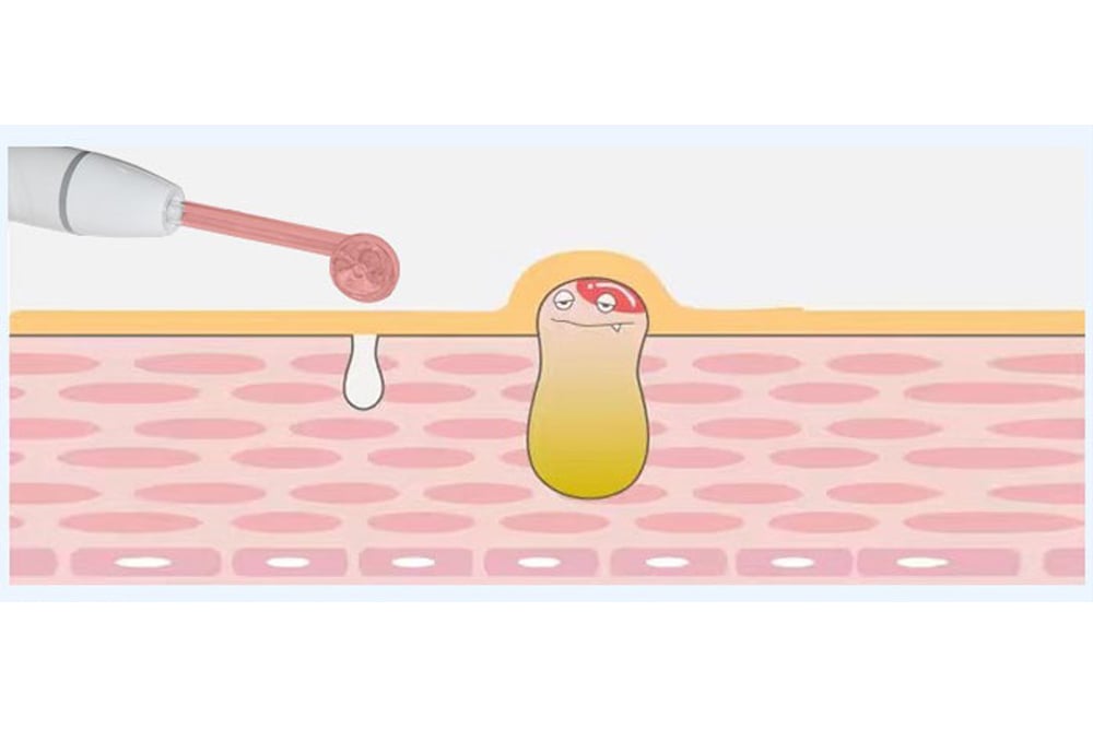 LB589 гидромассаж 14