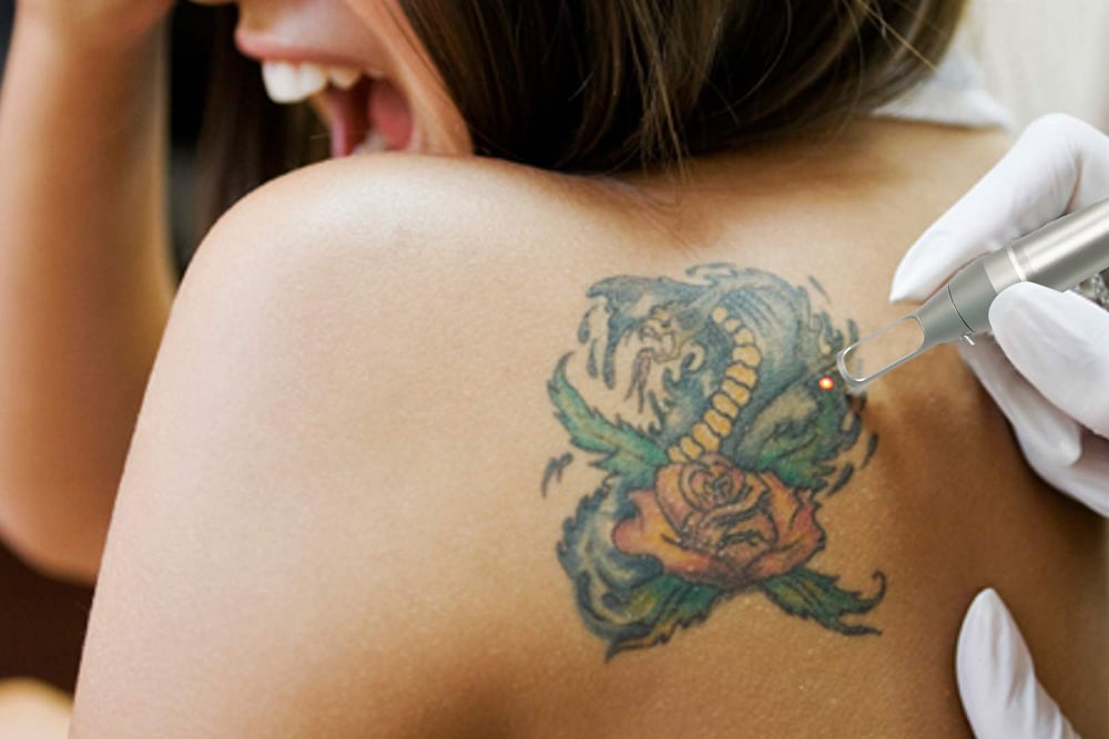 Laser picoseconde GN6406