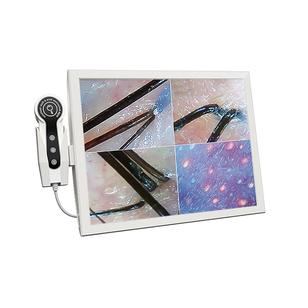 JC062 анализатор кожи3