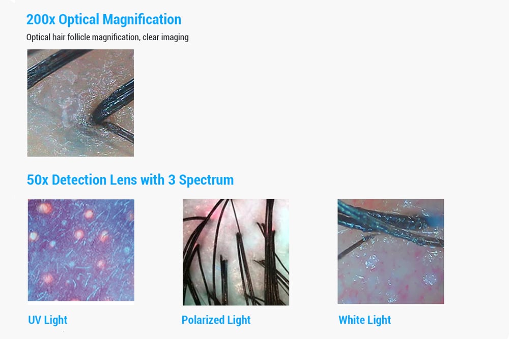 JC062 анализатор кожи6