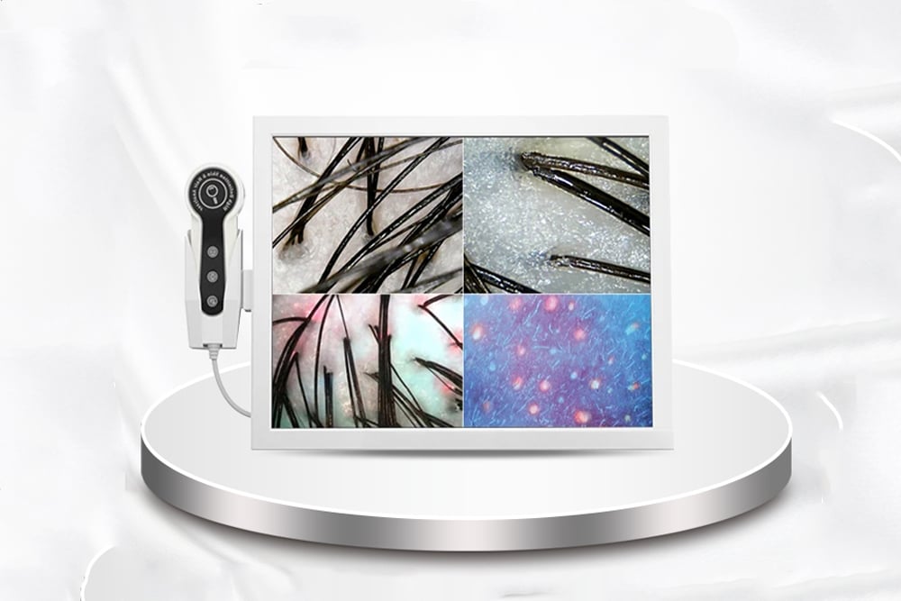 JC062 анализатор кожи8