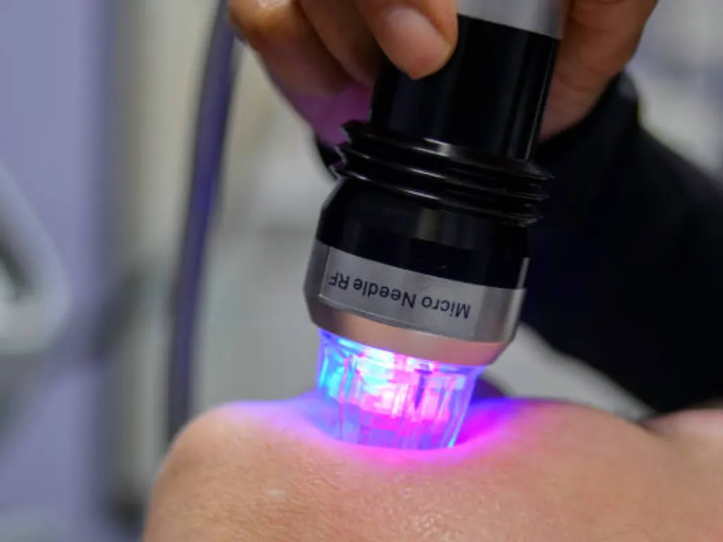 microneedling nazorg 4