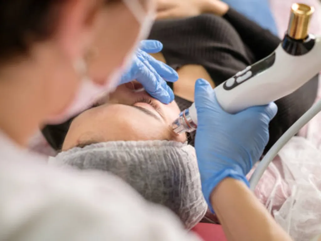 microneedling nazorg 5