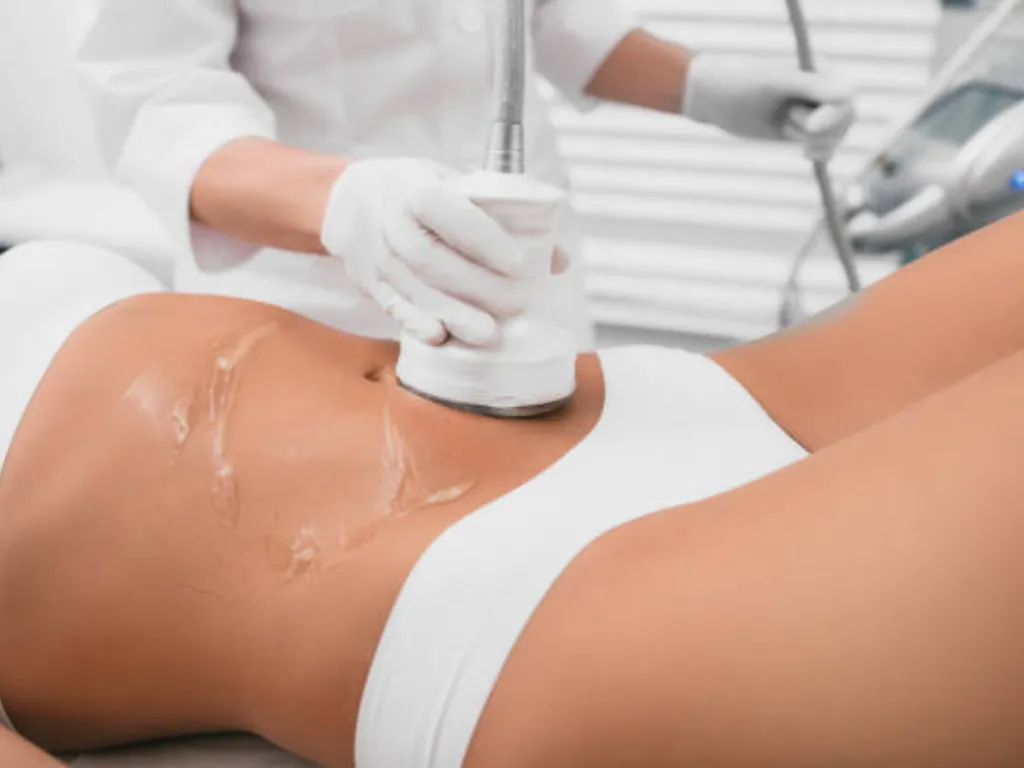 cavitation de l'estomac avant et après