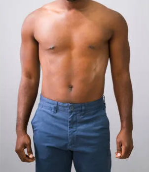 cavitation de l'estomac avant et après