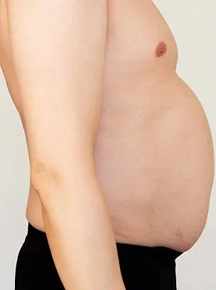 cavitation de l'estomac avant et après