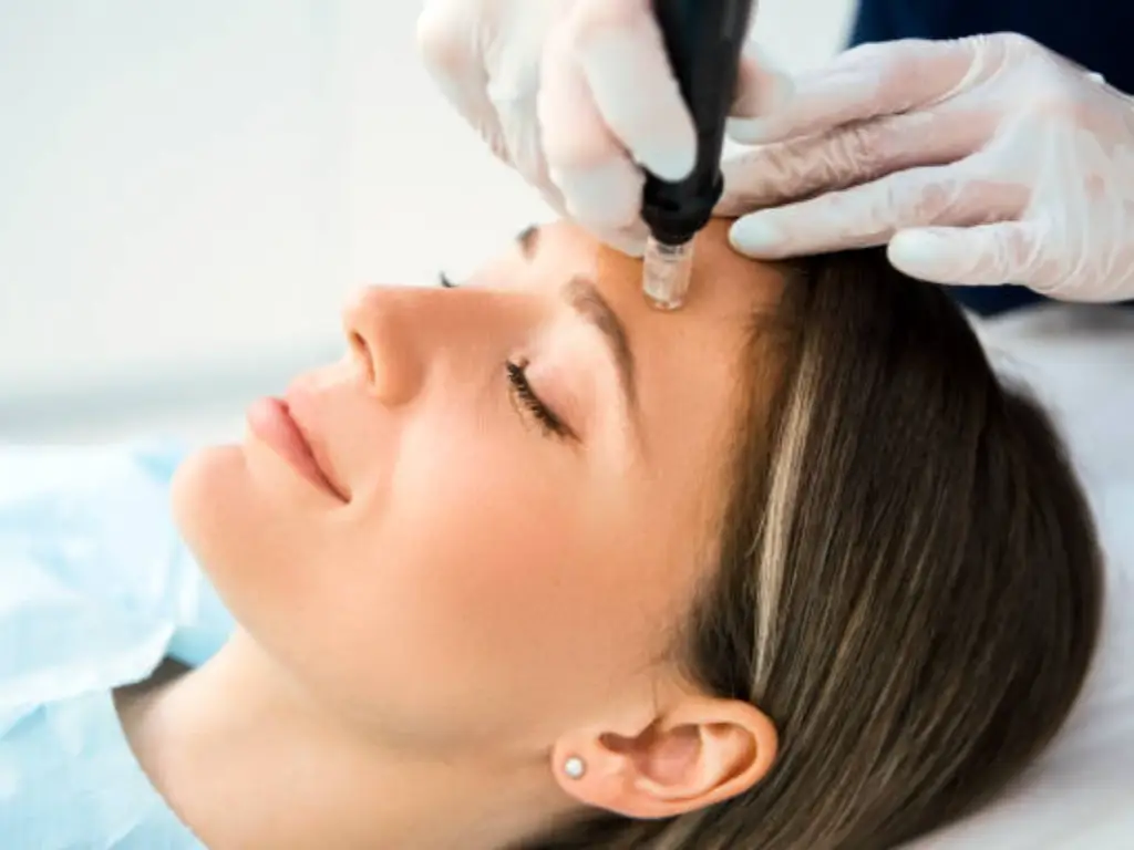 how often microneedling