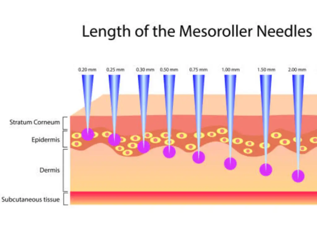 Combien de fois le microneedling doit-il être pratiqué ?