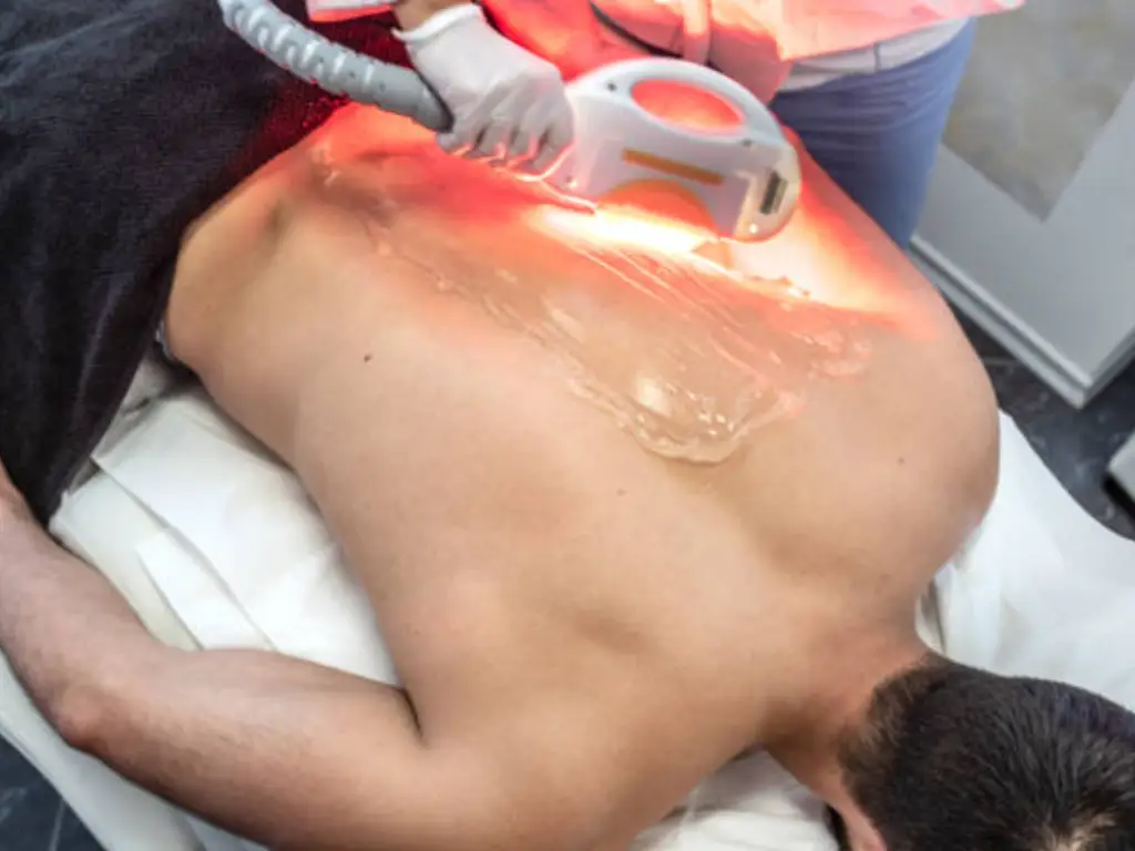 laser back hair removal cost