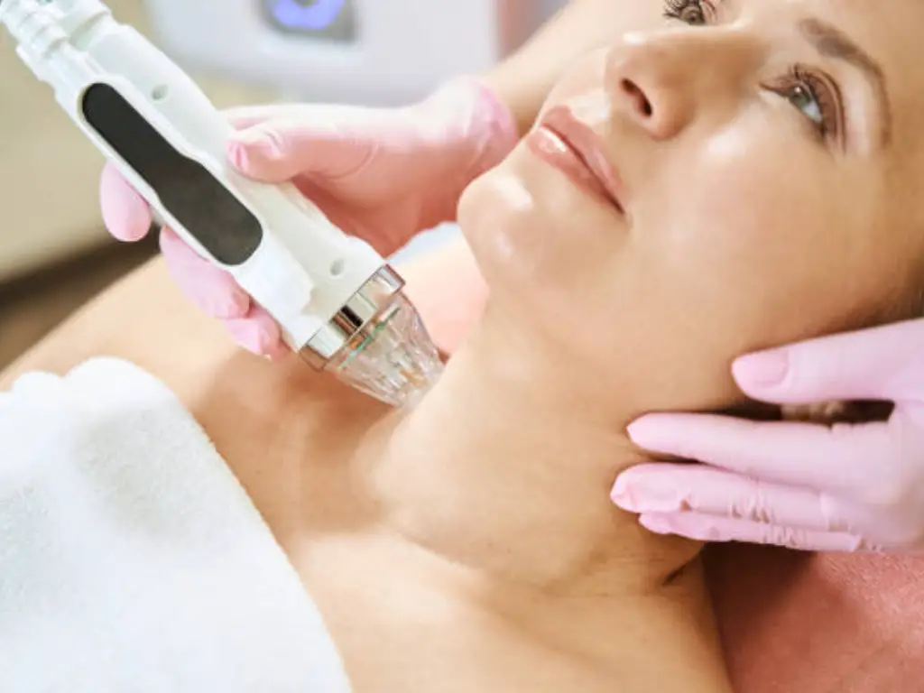 rf microneedling downtime