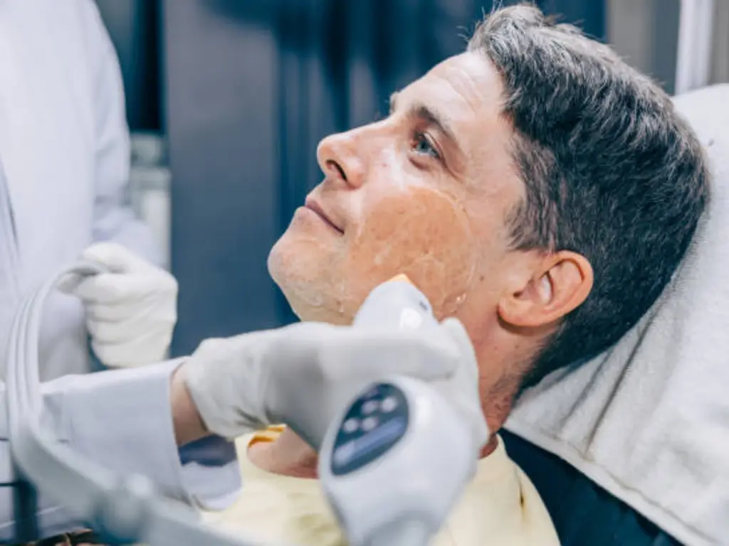 What is thermage treatment