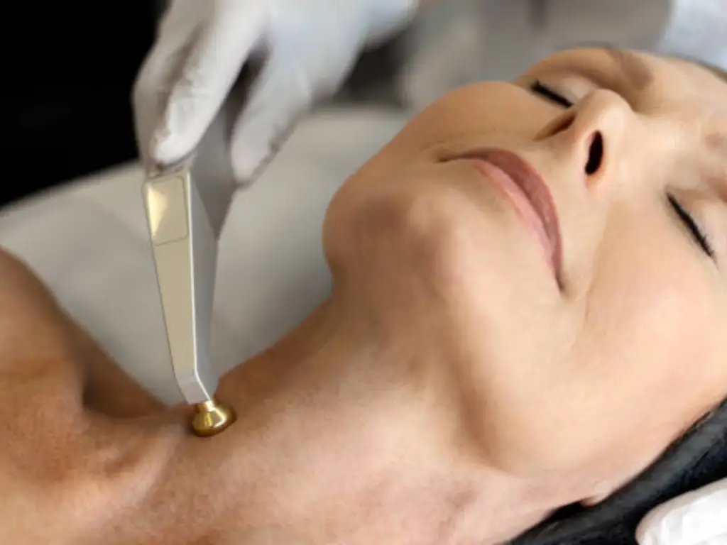 What is thermage treatment1