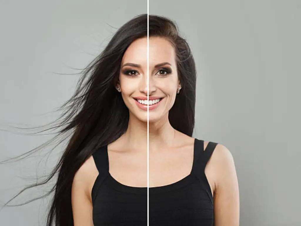 Résultats du soin du visage au laser CO2