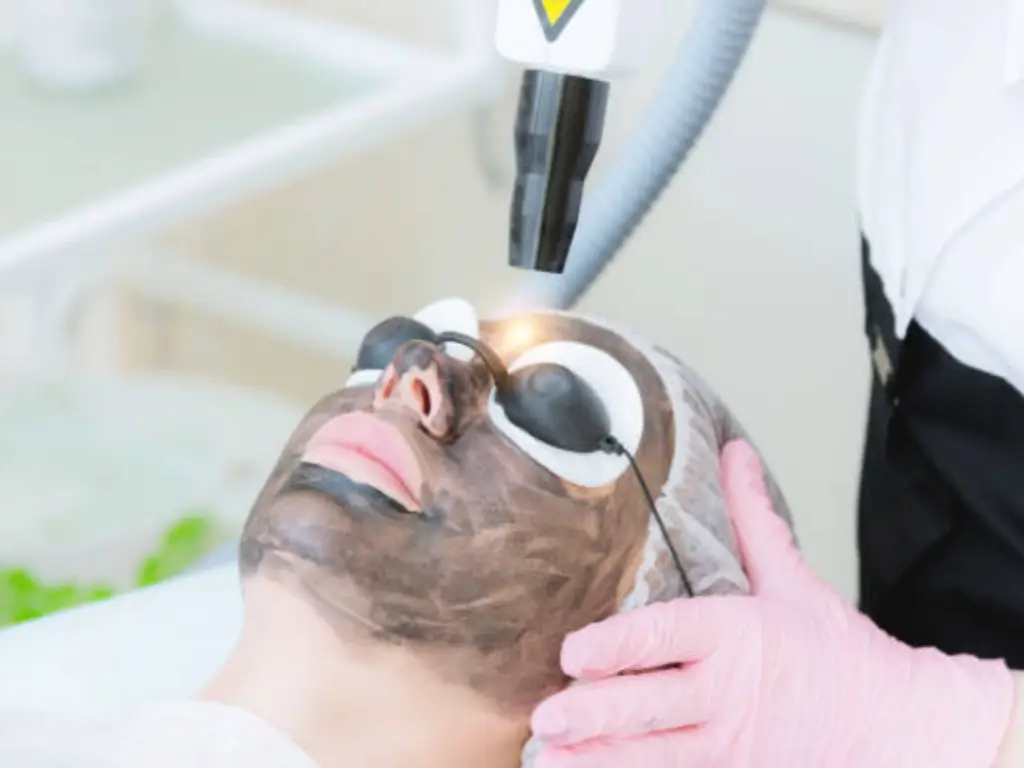 Soin du visage au laser au carbone : avant et après