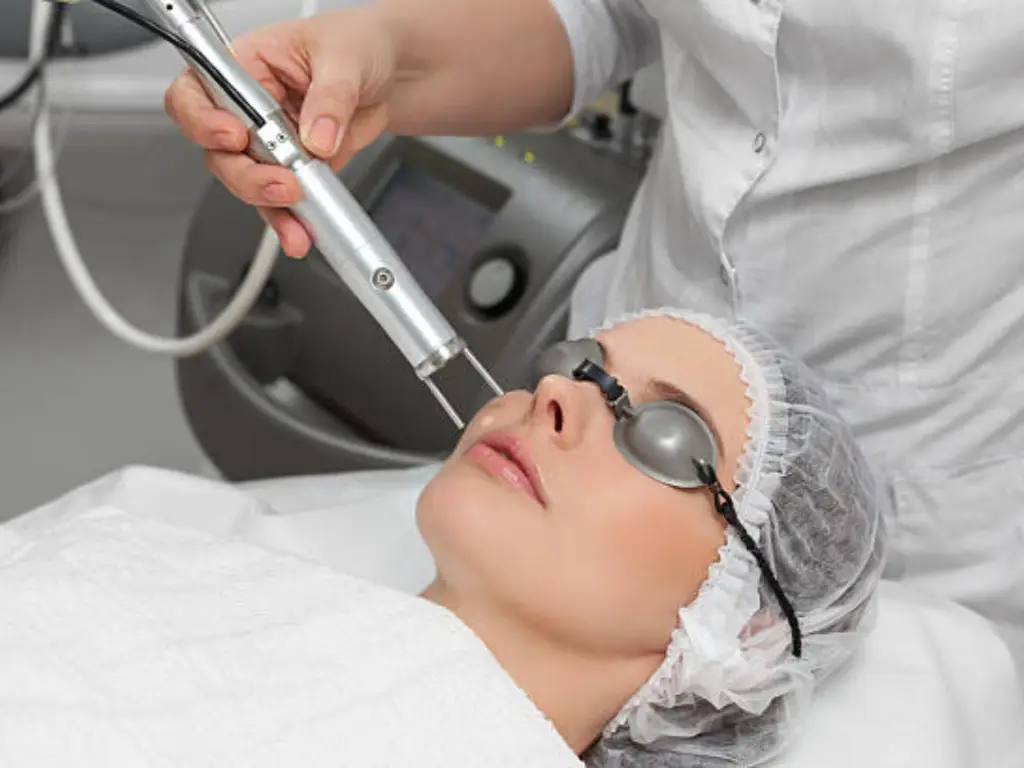 Coût d'un soin du visage au laser au carbone