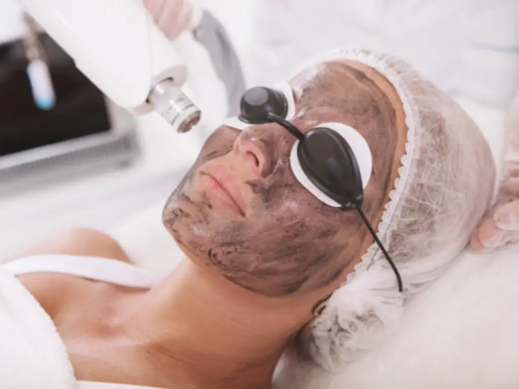 soin du visage au laser au carbone