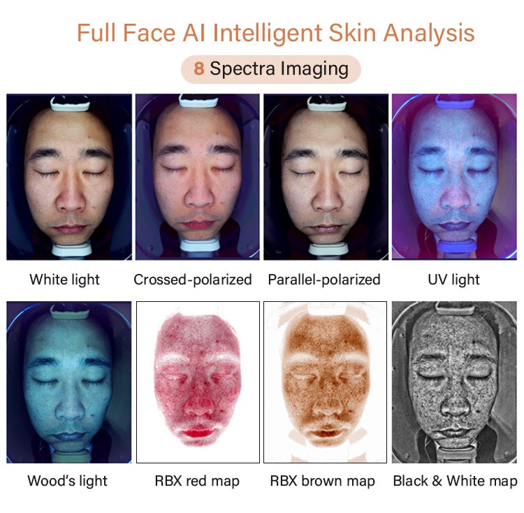 8 spectra imaging on the JC089 AI skin image analyzer: white light, crossed-polarized, parallel-polarized, UV, Wood's light, RBX red map, RBX brown map and black and white map
