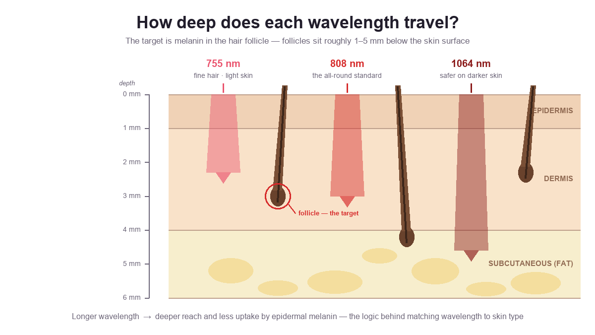 Skin cross-section showing how 755nm, 808nm and 1064nm diode laser wavelengths reach different depths toward the hair follicle