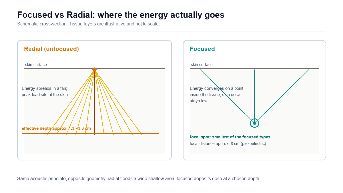 Schematic cross-section comparing radial shockwave energy spreading in a fan near the skin versus focused energy converging at a point inside tissue