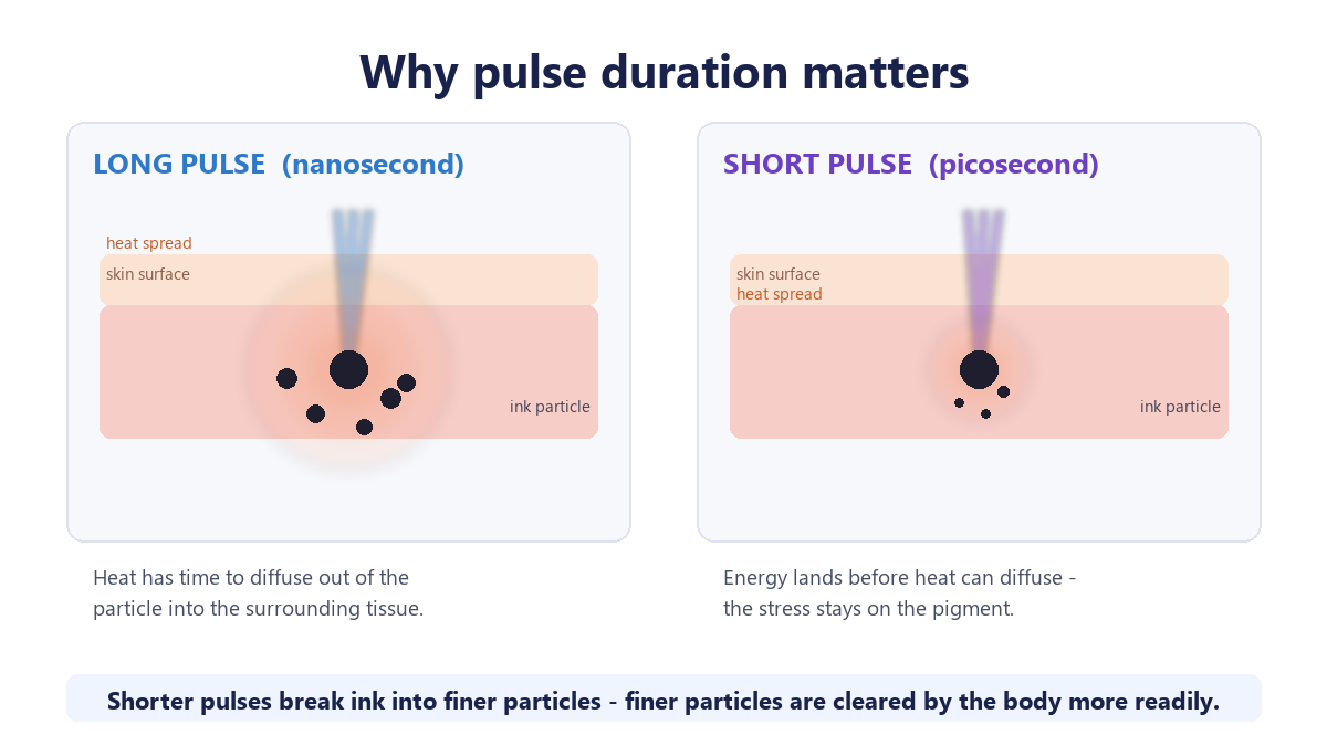 Long pulses let heat diffuse into surrounding tissue; short pulses keep the stress on the pigment.