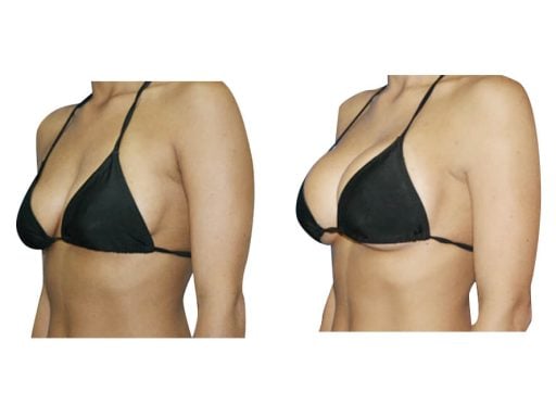 borst bil hefmachine FX051D 10