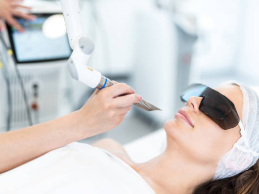 soorten laserontharing