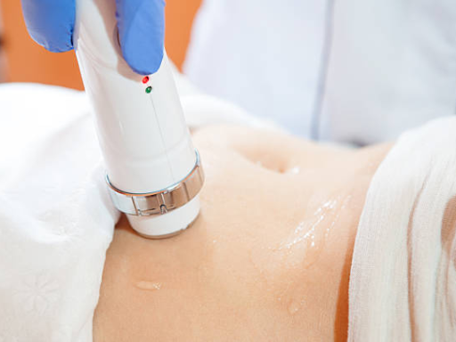 la cavitazione è permanente