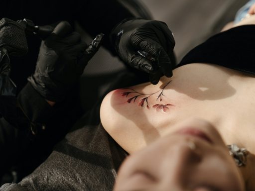 tatoeage verwijderen