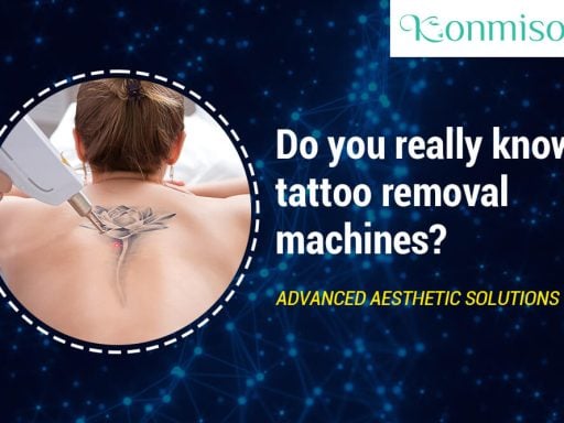 tattoo removal
